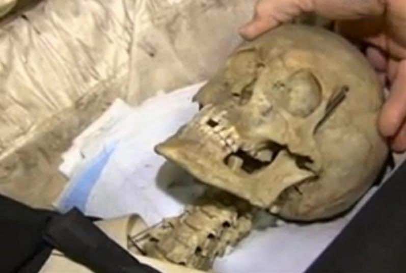 أسنان تشرشل وخصلة شعر لينكولن..من اغرب ما بيع في المزاد!