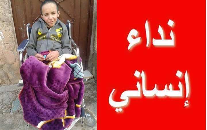 طفل مهدد بالشلل يستنجد بذوي القلوب الرحيمة