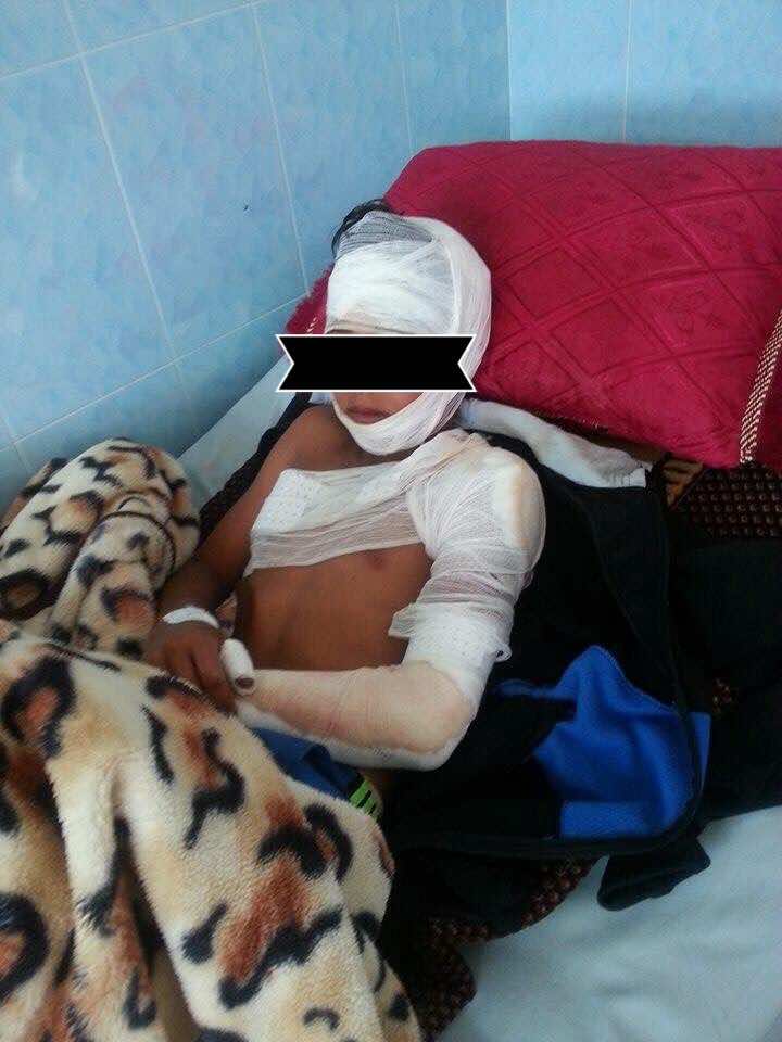 فيديو: حادثة سير خطيرة في ضواحي بركان والضحايا أغلبهم قاصرين