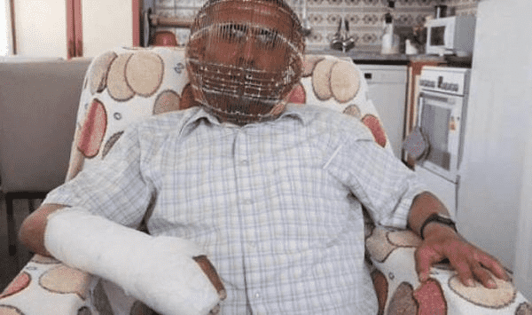 مواطن يضع رأسه داخل "قفص حديدي مقفل" للإقلاع عن التدخين