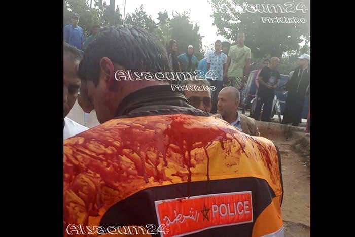 نزاع على فتاة يتسبب في إصابة شرطي بجرح في رأسه في البيضاء