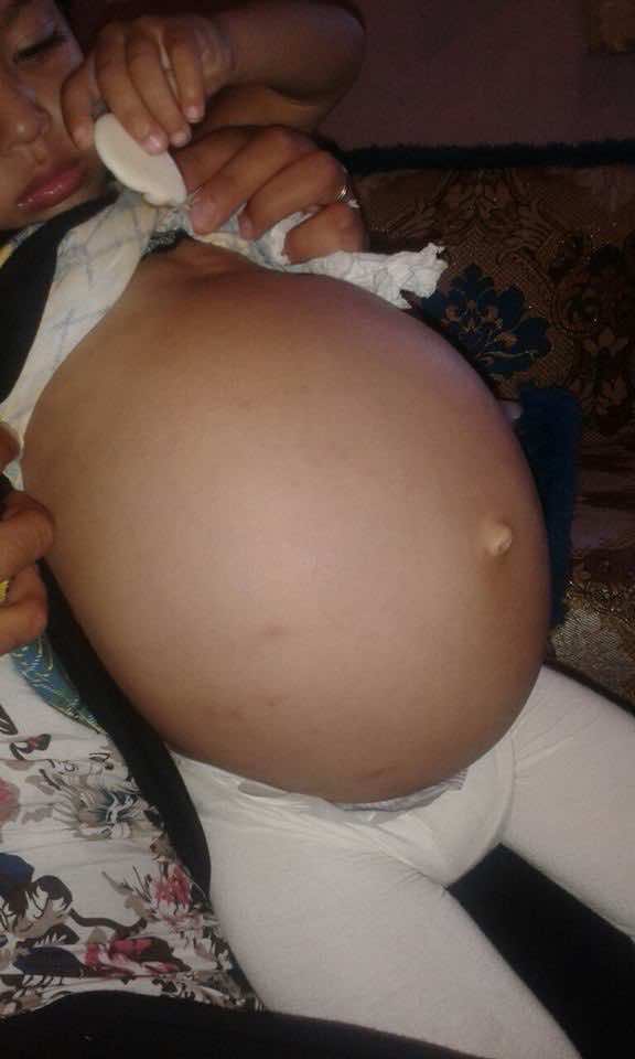 الصغيرة غفران تطرق باب المحسنين لمشاركتها رحلة الصراع مع سرطان الكبد