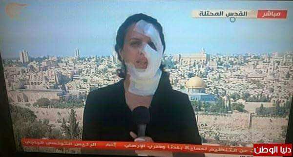 مراسلة الميادين تستأنف عملها بالضمادات ساعات بعد إصابتها في غارة-فيديو