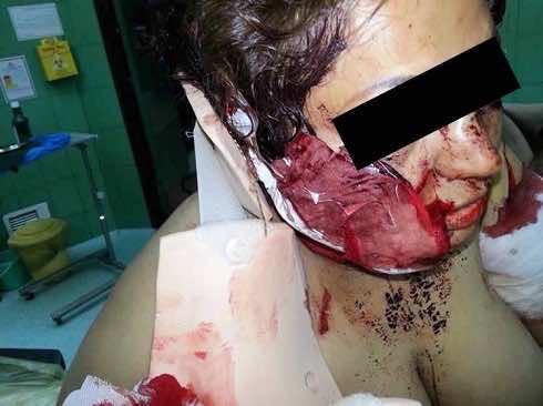 عصابة "تُشرمل" فتاة على طريقة "الساموراي" بأكادير أوفلا- صور صادمة