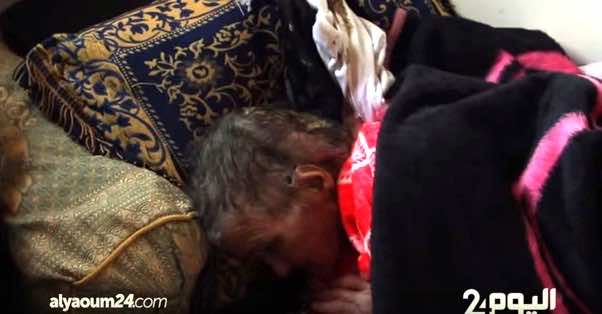 مؤلم..التعفنات تنهش رأس سبعينية بسلا تحالف ضدها المرض والفقر -فيديو