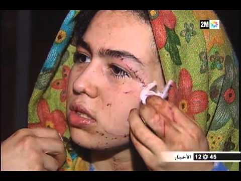 عيون نسائية دراسة تفضح عنف الرجال ضد النساء بالارقام