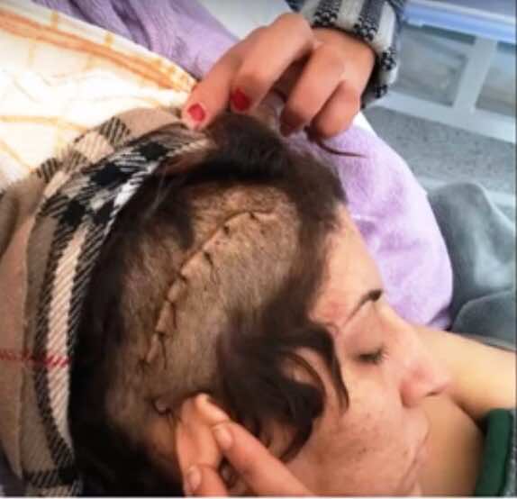 1200 "غرزة لتقطيب جروح راقصة"شرملها"عشيقها بملهى ليلي!- صور