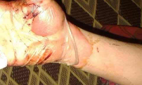 خطير..اعتقال زوجين في سلك الأمن بتهمة تعذيب شاب بمنزلهما!