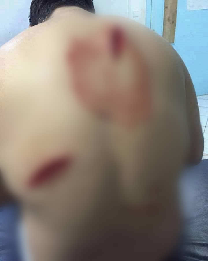 مهاجمة حارس ليلي بالسيوف و"الماء القاطع" في طنجة-صور