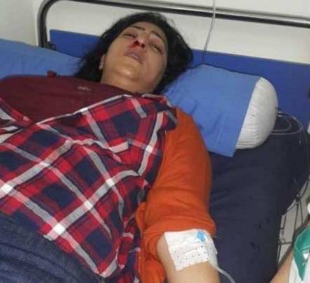 مواطنة من البيضاء تكسر أنف الفنانة دنيا بوطازت- صورة