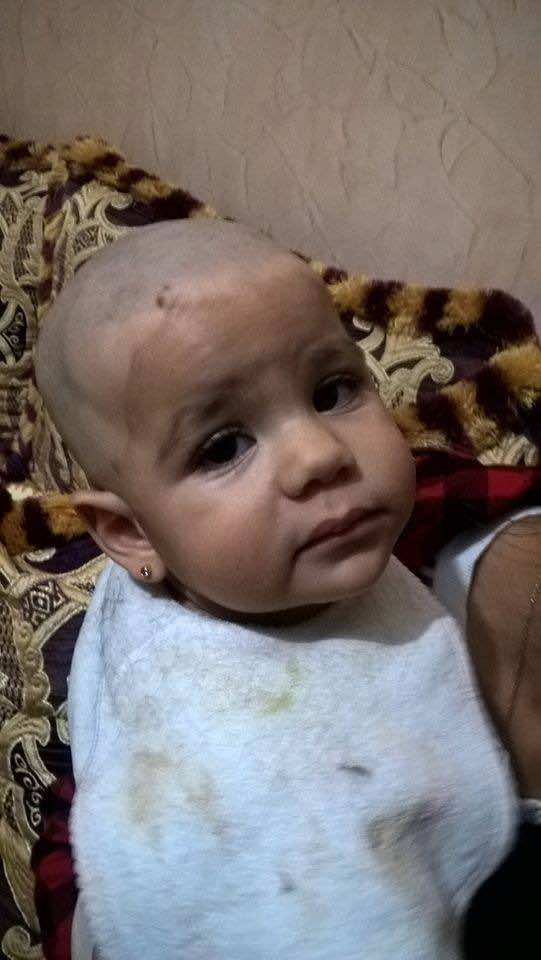 أريج..رضيعة تحتاج للمساعدة للانتصار على السرطان