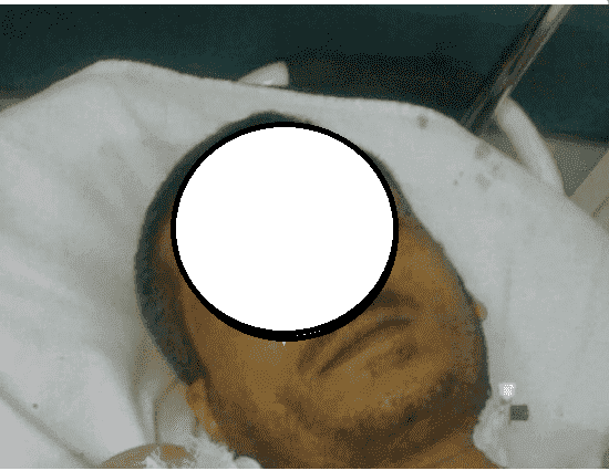رئيس جماعة"ينطح"عون سلطة ويرسله إلى المستعجلات في حالة حرجة
