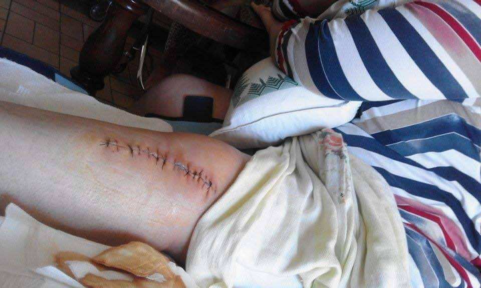 أم تتعرض لاعتداء "شنيع" من طرف 3 أشخاص بحضور ابنتها القاصر - صور