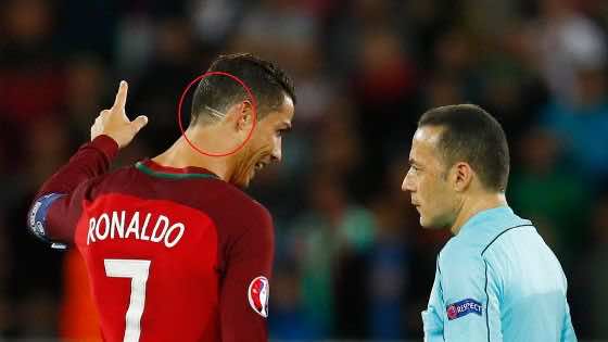 رونالدو يتضامن مع طفل مصاب بالسرطان خلال كأس أوروبا