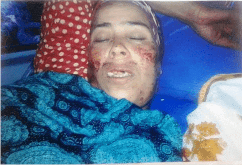 سقوط 3 أسنان و6ساعات في "الكوما"..حصيلة ضربة رأسية وجهها مواطن لمستشارة استقلالية