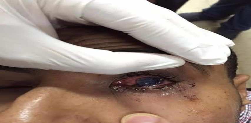 بائع سمك متجول يفقئ عين ممرض داخل المستشفى!
