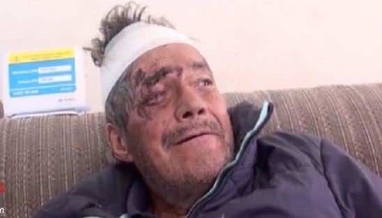 بعد شهرين من وفاته.. عائلة تُفاجأ بعودته الى الحياة!