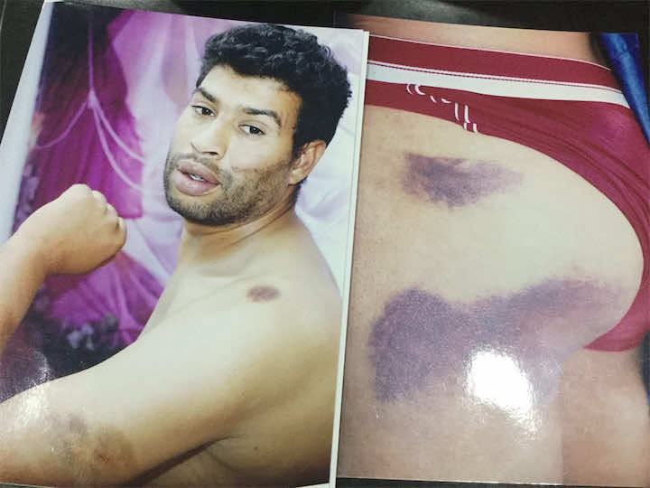 مواطن يتهم عوني سلطة بتعنيفه: كنت أطلب العفو وهم يضربون!-فيديو