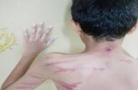 أستاذ يرسل تلامذته للمستشفى بعد “جلدهم”  بوحشية!