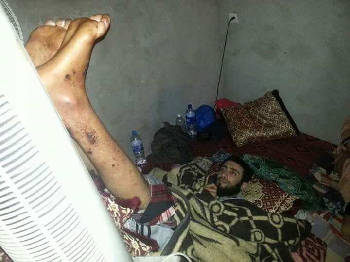 مأساة.. مرض ناذر يكلَّف مواطنا رفع رجليه ليل نهار أمام "مبرد" - صور