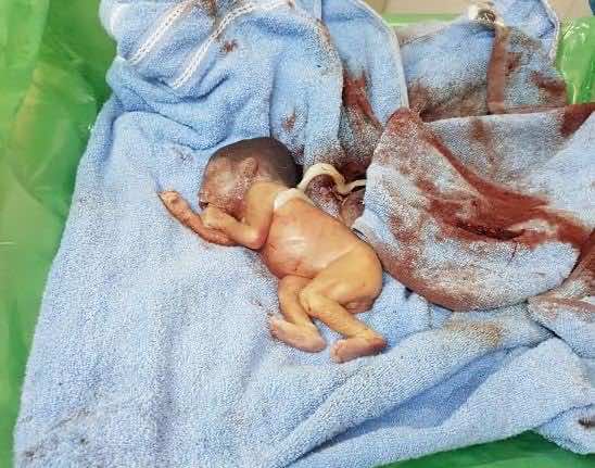 جثة جنين تستنفر المصالح الأمنية في الدارالبيضاء