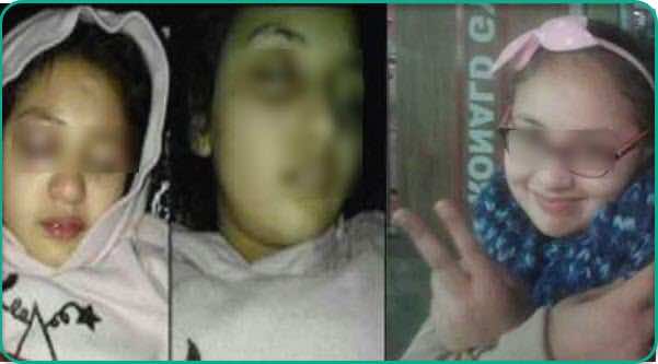 بعد جدل التشريح.. ملف الأستاذة والطفلة هبة يعود إلى الواجهة
