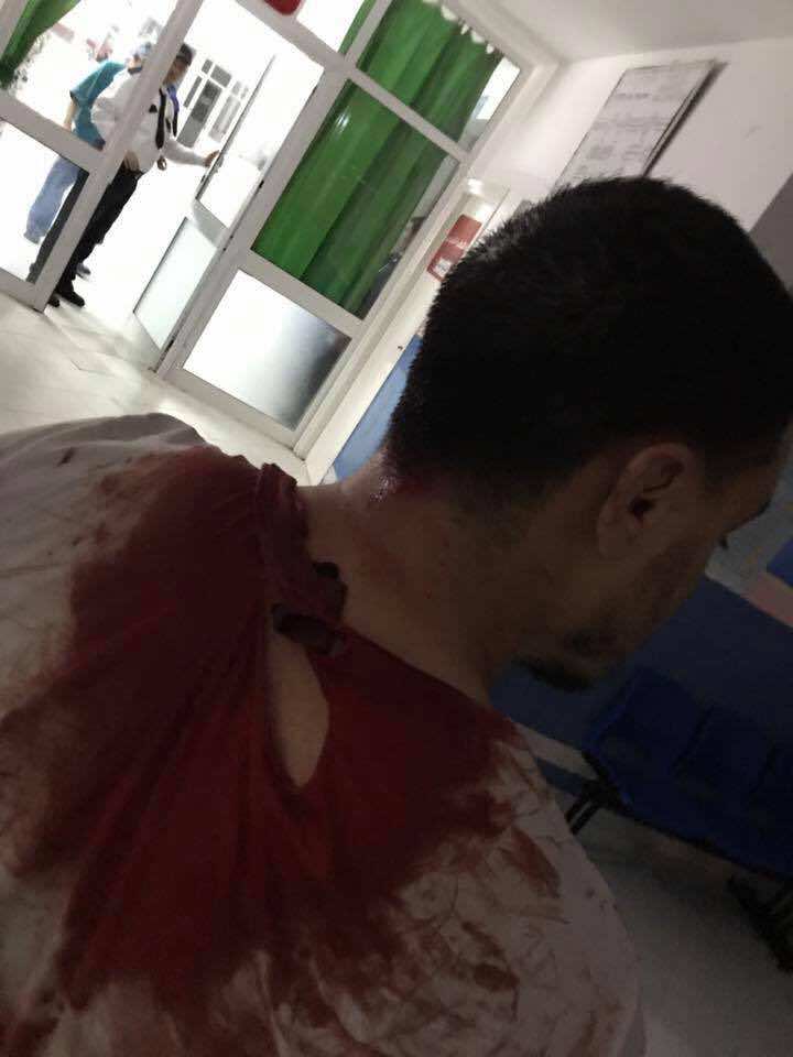 متضامنون مع معتقلي الريف بتطوان يشتكون استعمال السلطة لـ"البلطجية" لتفريقهم - صور
