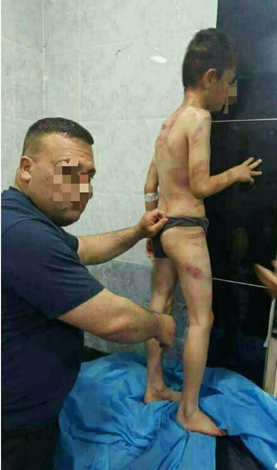 القصة الكاملة لطفل تعرض لتعذيب روع العالم بسبب تأخره خارج البيت!-فيديو
