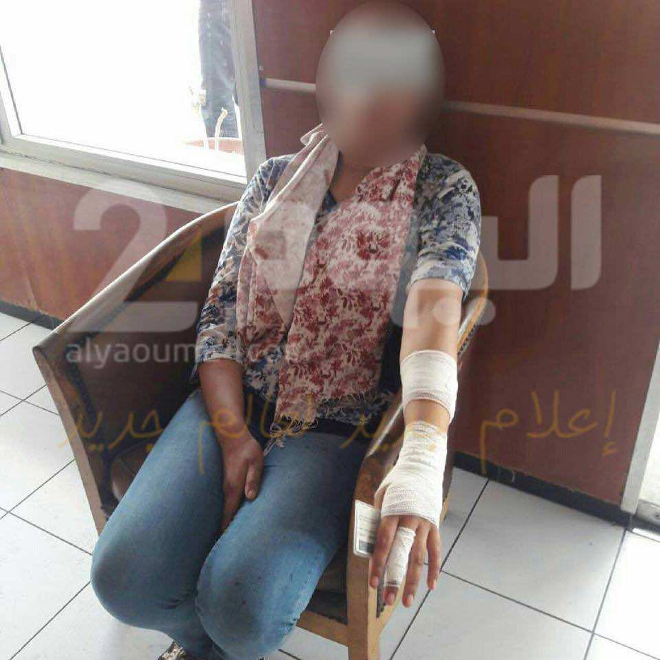 في قلب البيضاء..مجرم "يشرمل" معلمة ويسرق حقيبتها- صور