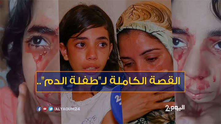 القصة الكاملة لـ"طفلة الدم"..الدم يخرج من عينيها وأذنها وجلدها!- فيديو