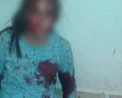 8 أشهر حبسا فقط لشخص "شرمل" شابة رفضت الزواج له..تسبب لها في 38 غرزة!