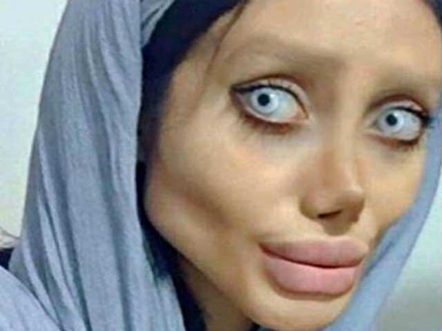 شبيهة أنجيلينا جولي "المشوهة" خدعت العالم!-صور