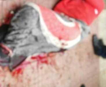 طعن تلميذ في ساحة إعدادية بطنجة.. والأمن يوقف الجاني