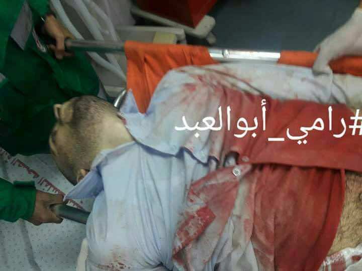 شهيدان وعشرات الإصابات في جمعة الغضب الثالثة بفلسطين -صور