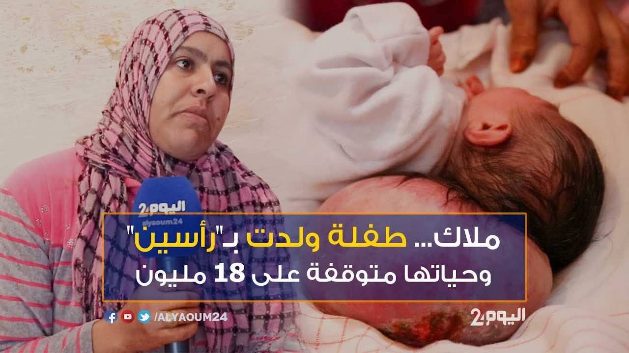 ملاك تجري عمليتها الجراحية الأولى لإزالة الورم وهذه حالتها الصحية
