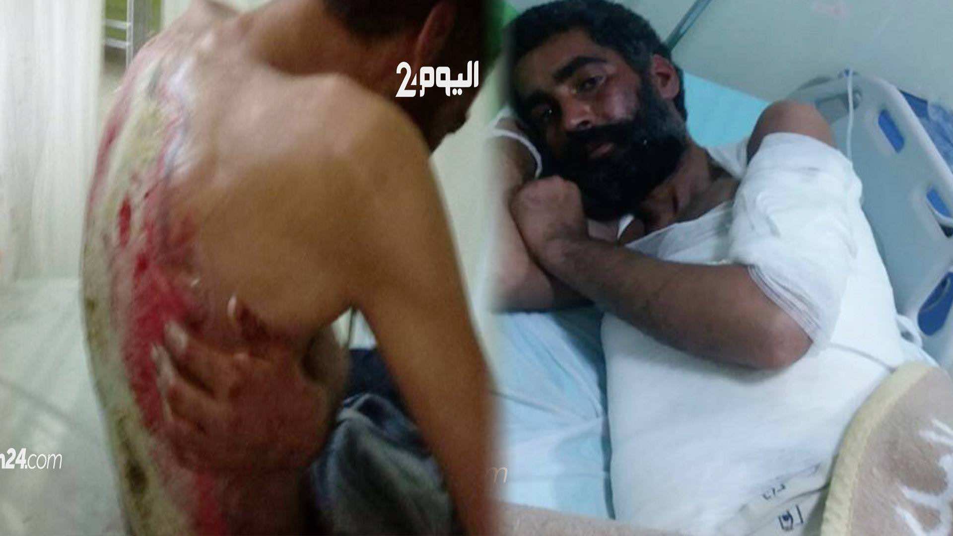 متشرد يأكل الدود جسده.. وأبناء فقيه بنصالح ينقذونه- فيديو