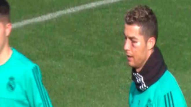 رونالدو يشارك في تداريب الريال بـ"عين منتفخة"