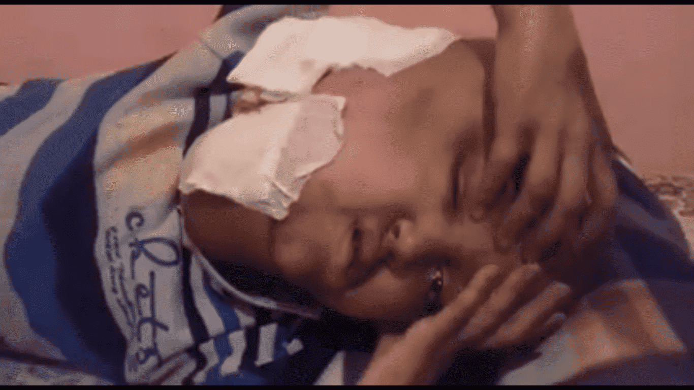 فيديو صادم.. ورم سرطاني في الرأس يحول حياة طفل يتيم الأب إلى جحيم