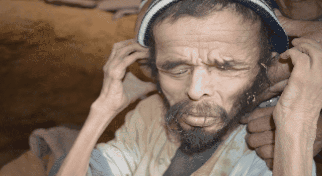 صادم .. كهل وزنه 10 كيلوغرامات ويأكل الديدان في كهف