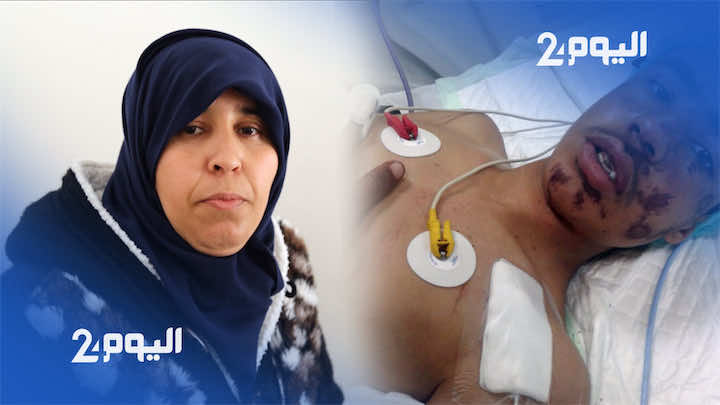 والدة الطفل المصاب في جرادة: ولدي "مدكدك" والطغاة حكرونا..واش حنا في غزة!-فيديو