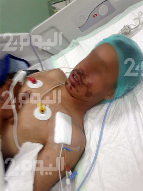 عائلة الطفل المصاب في جرادة مطالبة بتوفير مستلزمات عمليته! -وثيقة