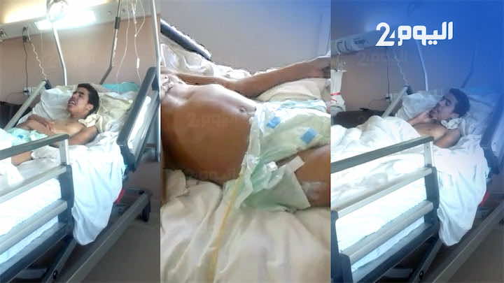 معاناة طفل مصاب بجرادة داخل المستشفى ووالدته تطلب إنقاذه-فيديو