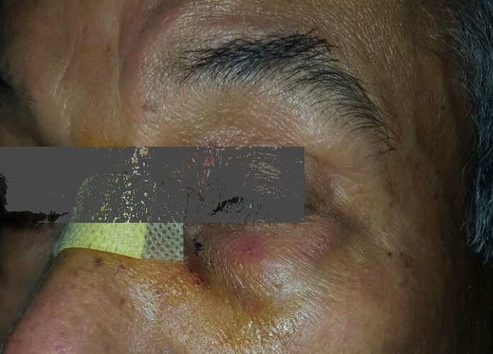 دركي يهشم أنف متقاعد بسبب ممر الراجلين