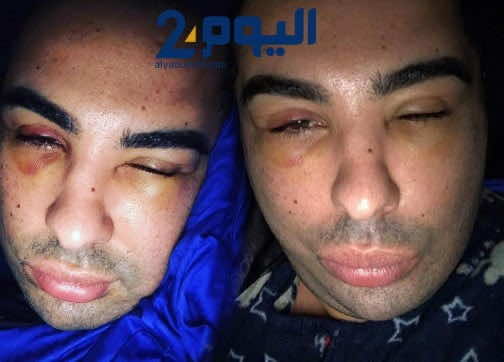 دوك صمد يرد على المشككين في صحة الاعتداء عليه.. وهذا ما قاله