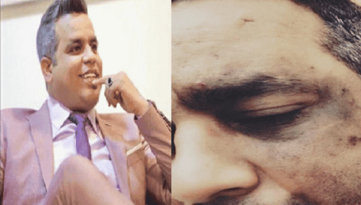 جوادي يكشف تفاصيل الاعتداء عليه: ضربوني بالنص وكروشيات وقالو لي باش تسد فمك