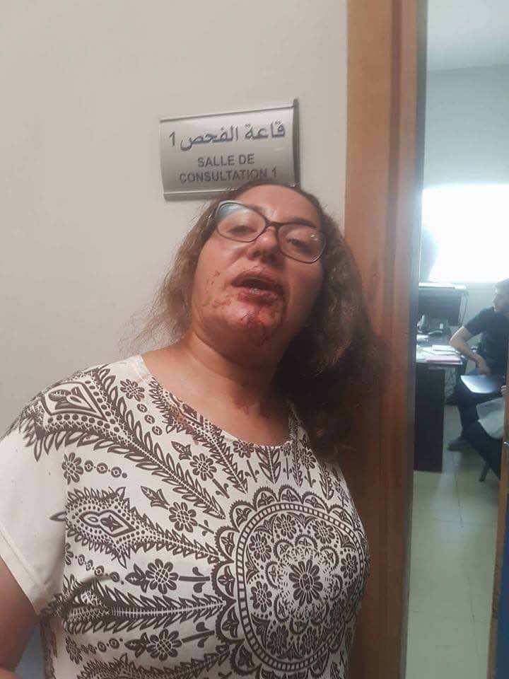 فيديو تعنيف عميد شرطة لسيدة يثير حالة من الغصب.. ومديرية الحموشي تحقق في ملابساته - فيديو