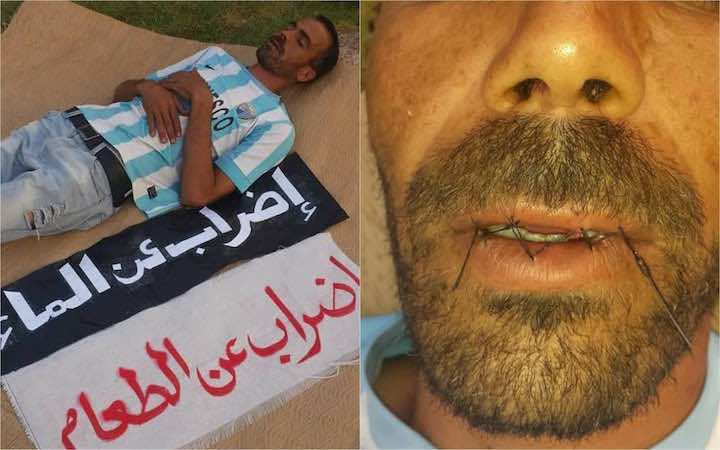 مصطفى قشو.. قصة مواطن خاط فمه احتجاجا على حرمانه من الاستفادة من مشروع المبادرة الوطنية للتنمية البشرية