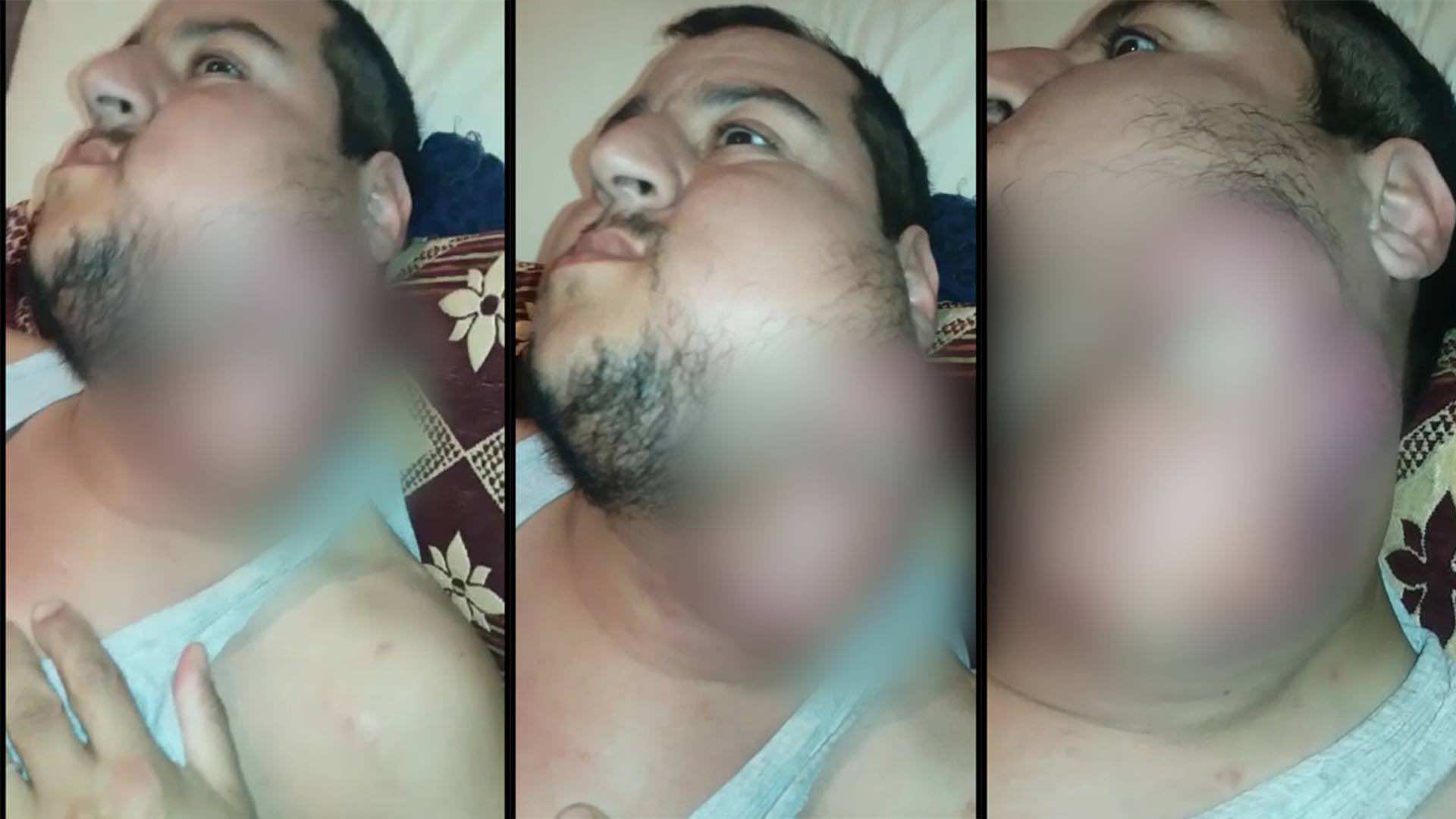عبد النبي يعاني ورما خبيثا يطلب المساعدة- فيديو