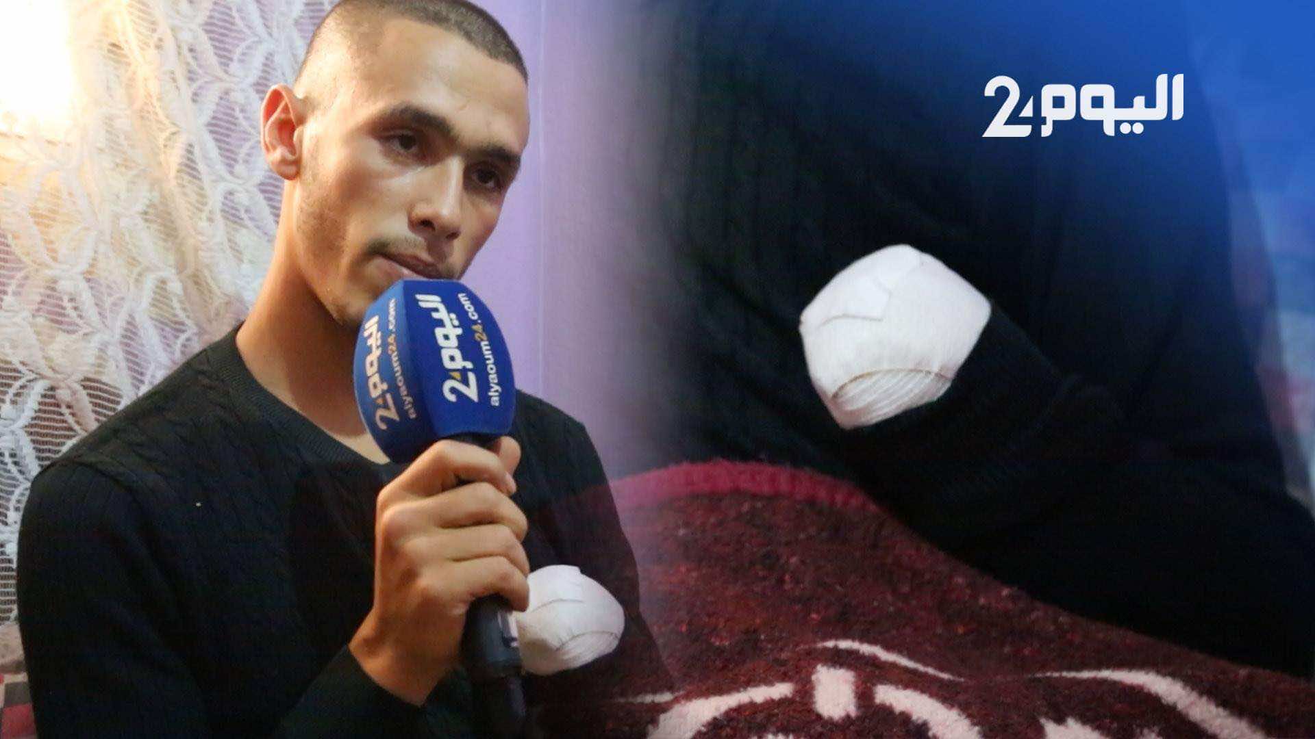 بعد مغادرته المستشفى.. معطيات وتفاصيل مثيرة يكشفها ضحية بتر اليد بالبيضاء لـ"اليوم24"- فيديو