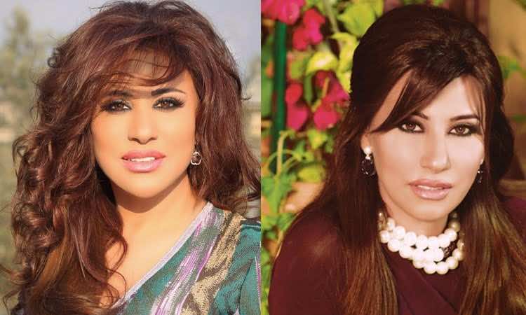 نجوى كرم تبرر خضوعها لعملية تجميلية لأنفها
